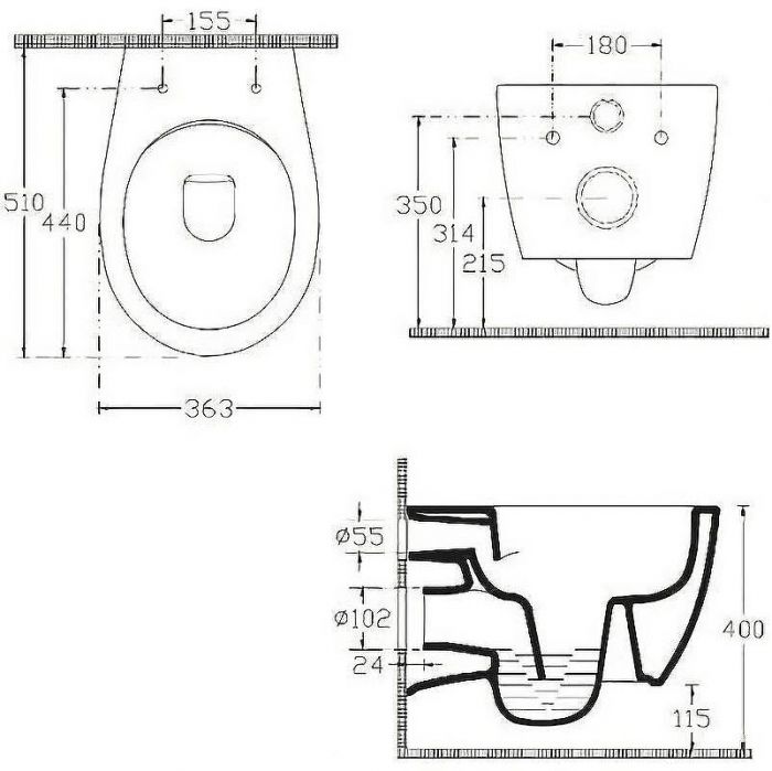 Унитаз биде Allen Brau Fantasy 4.11HC1.20 подвесной Белый без сиденья